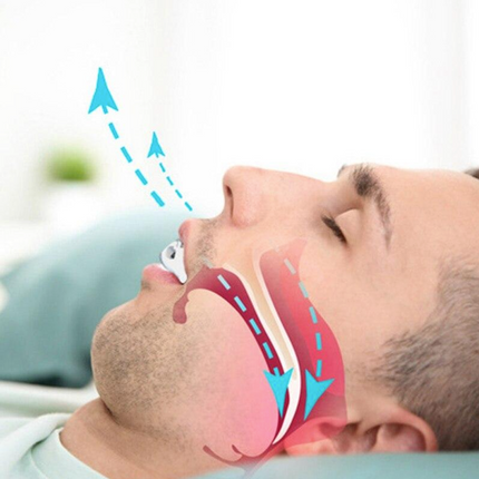 SNORING CARE - Appareil anti-ronflements