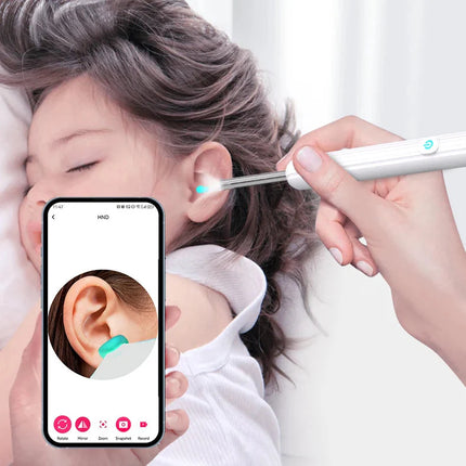 Nettoyeur Auriculaire Connecté – Compatible iOS & Android