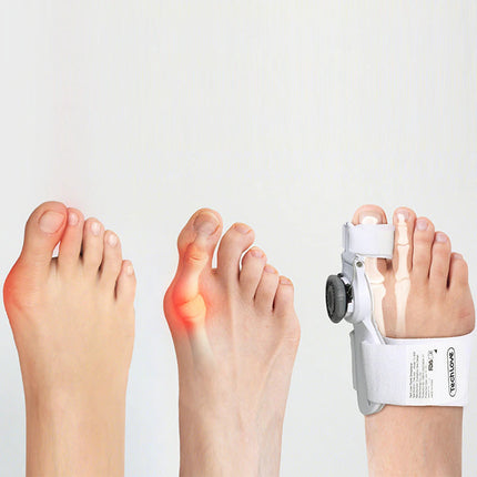 Attelle ajustable pour hallux valgus